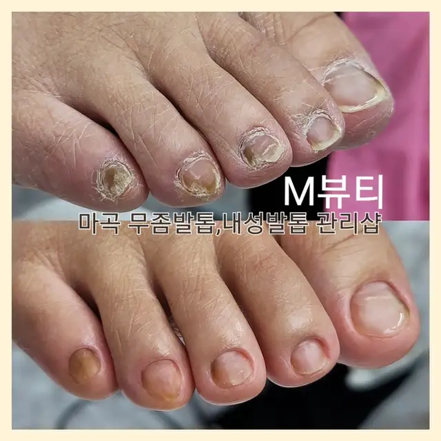 M뷰티 사진 5