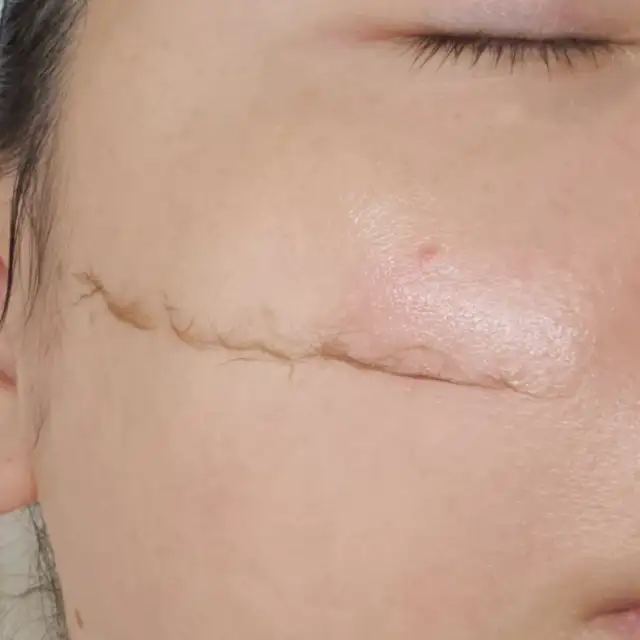 셀티션 사진 5