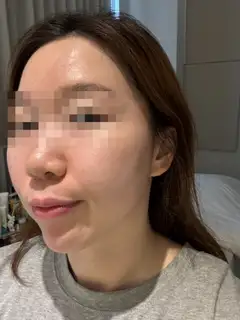 비앙에스테틱 사진