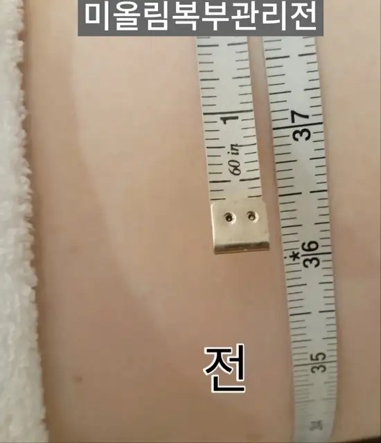 미올림 사진 6