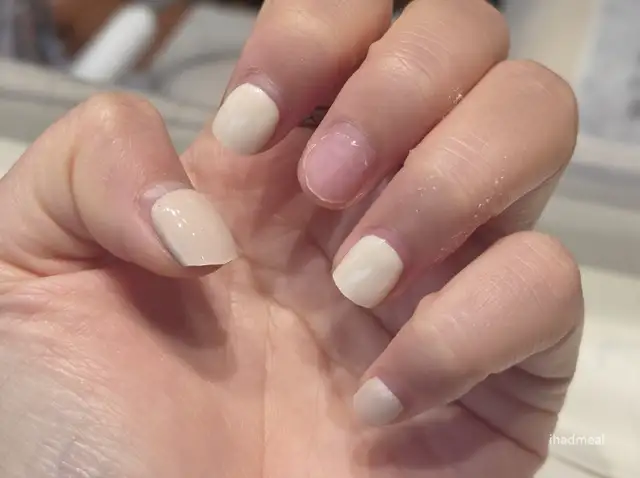하얀손톱 사진 5