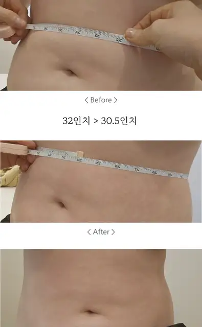 론디뷰티 사진 7