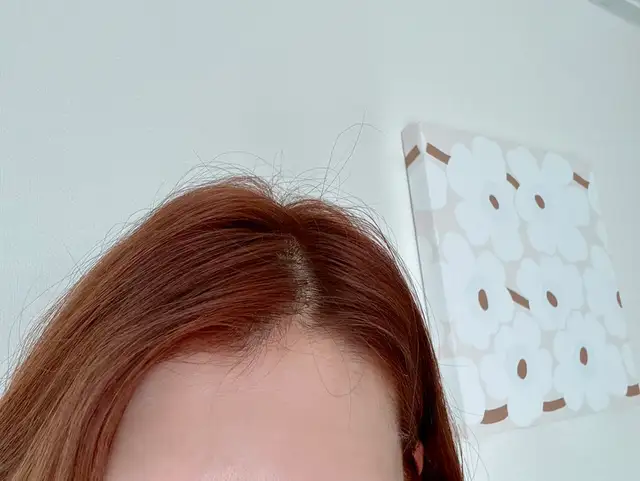 준헤어커커 사진 3
