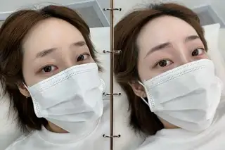 아르브 사진