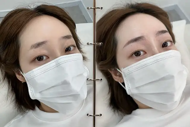 아르브 사진 1