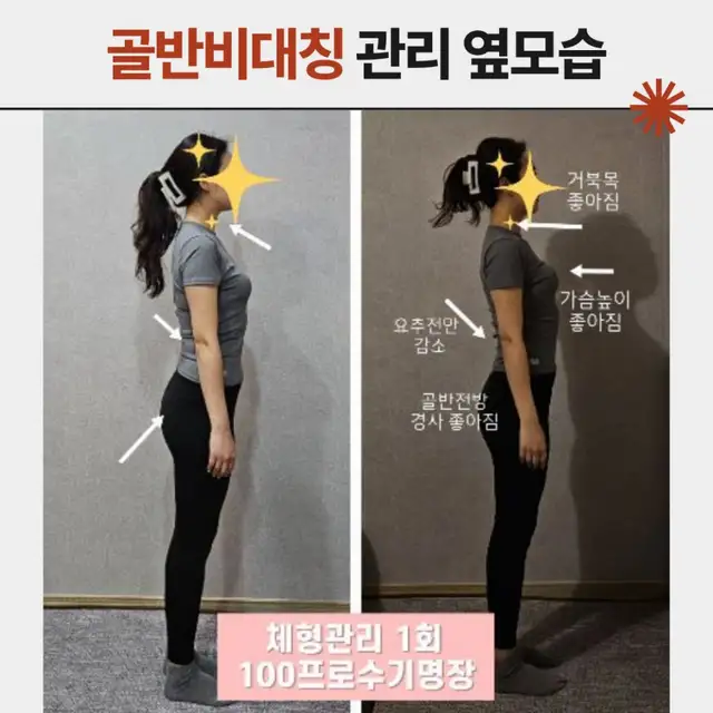 에스 사진 2