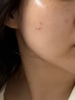 유헤이에스테틱 사진
