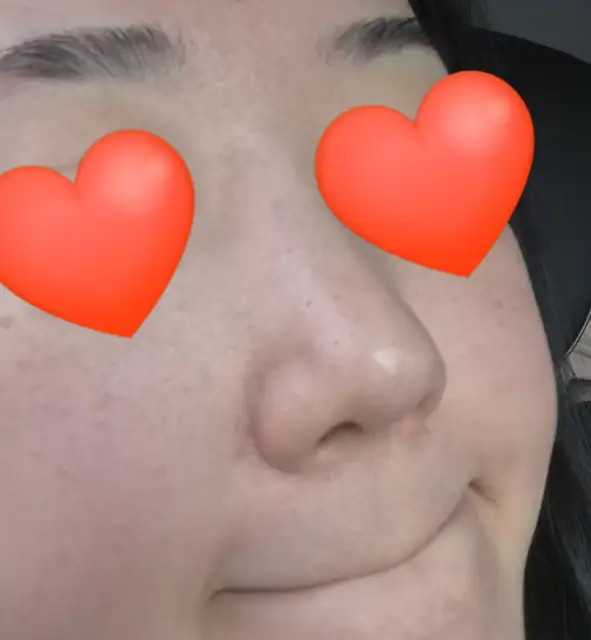 동탄휴에스테틱 사진 1