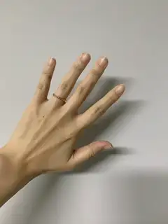 비오네일 사진
