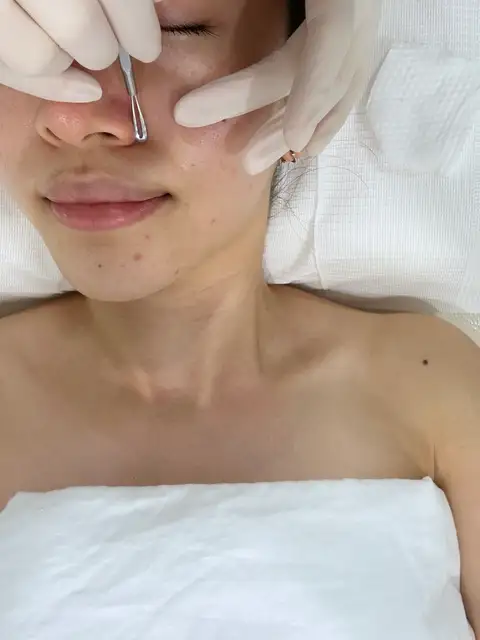 모브스킨 사진 4