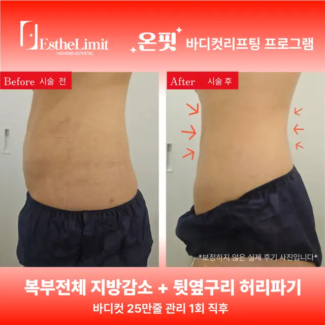 에스떼리밋 사진 4