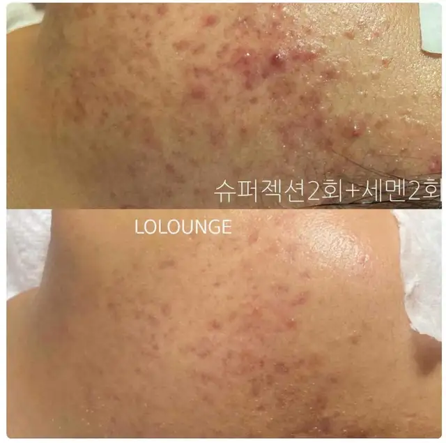 로라운지 사진 8