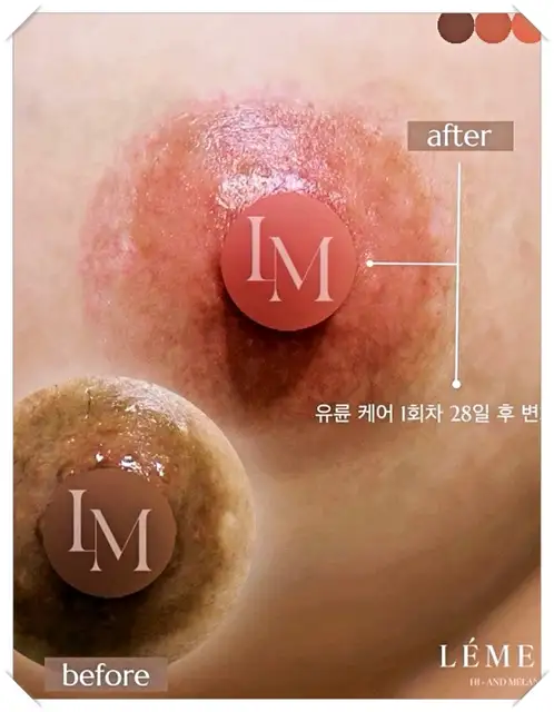 카라케어 사진 5