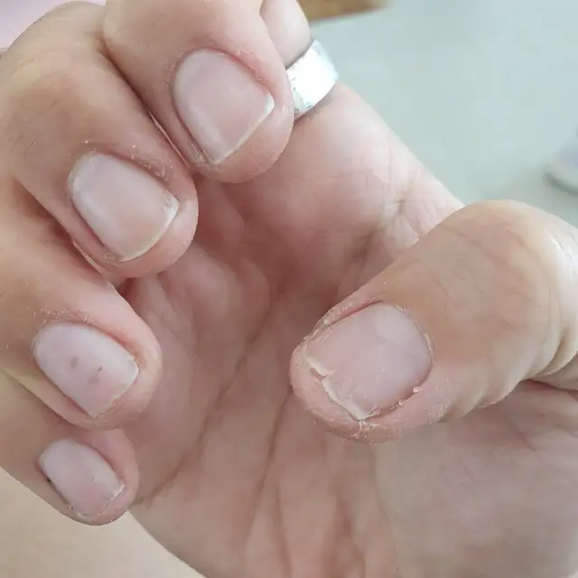 예삐네일 사진 6