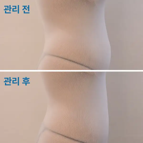 스파아루카 사진 7