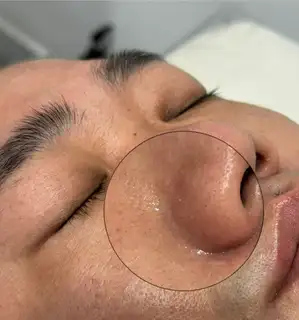 예쁘리 사진