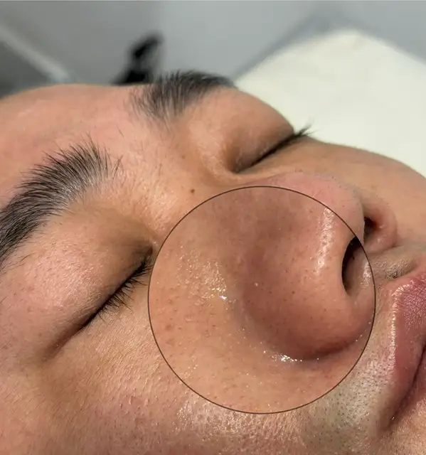 예쁘리 사진 1