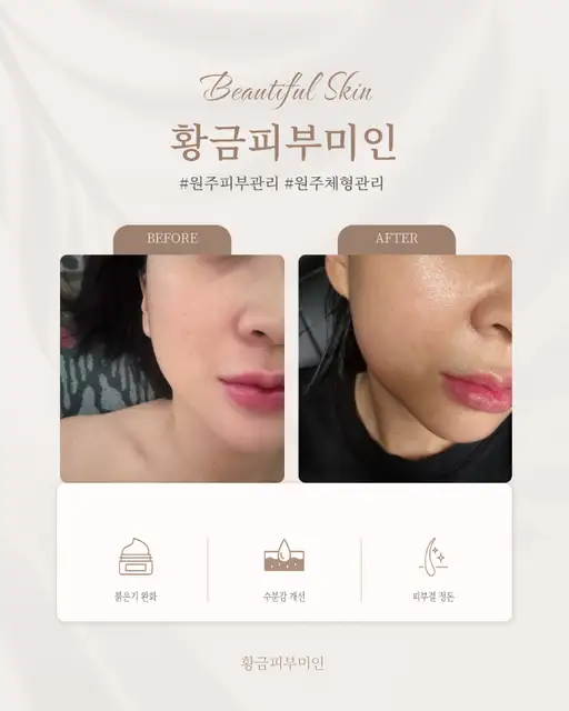 황금피부미인 사진 7