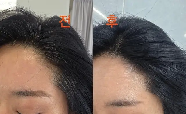 위븐 헤어 사진 2