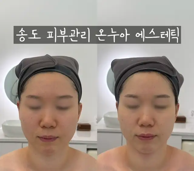 온누아에스테틱 송도점 사진 5