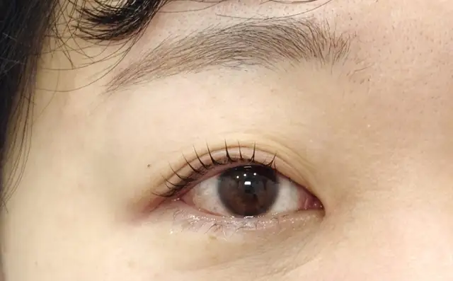 말랑래쉬 사진 6