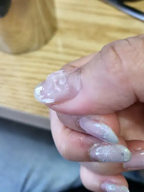 네일온제 사진 3