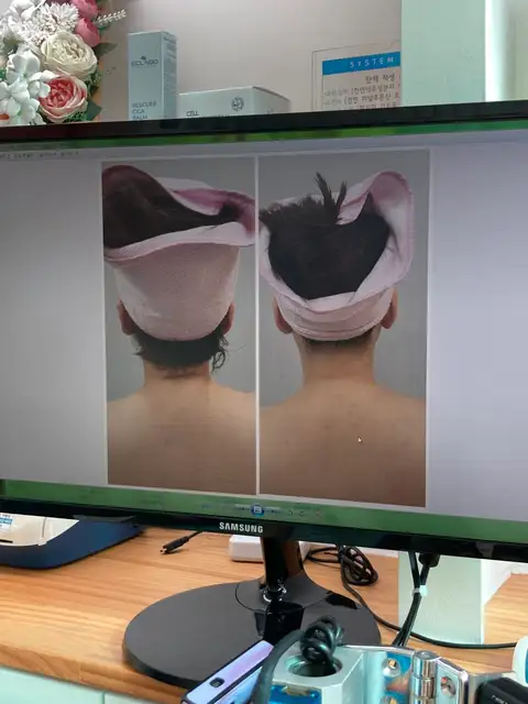 MK뷰티 사진 2