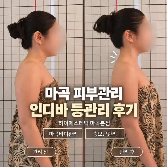 하이에스테틱 사진 1