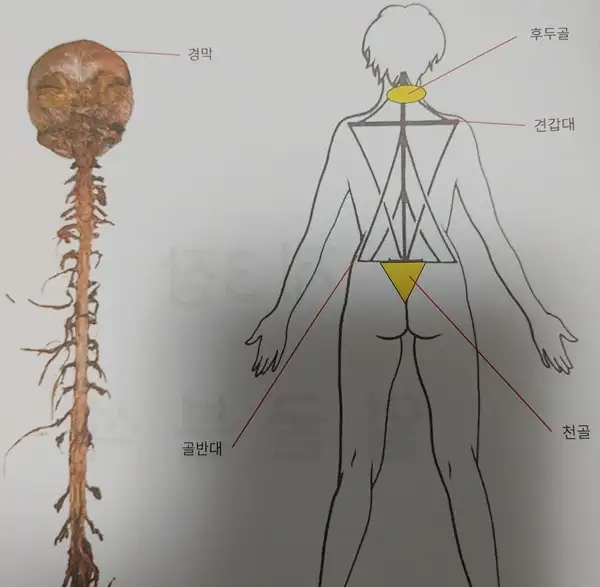 진테라피 사진 3