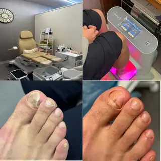 푸스인솔 사진