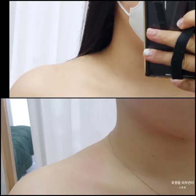 블로우숨 사진 5