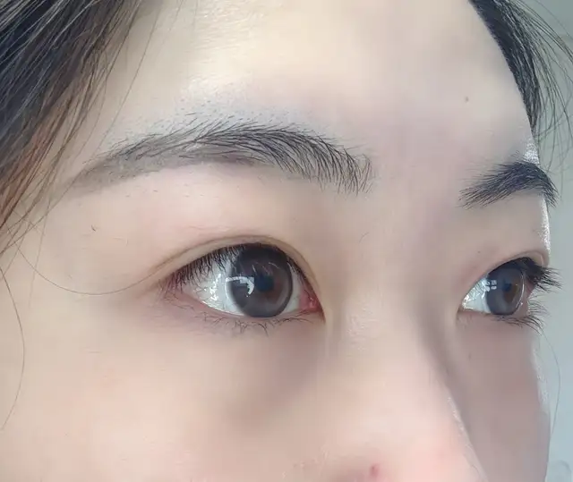아이티나뷰티 사진 8