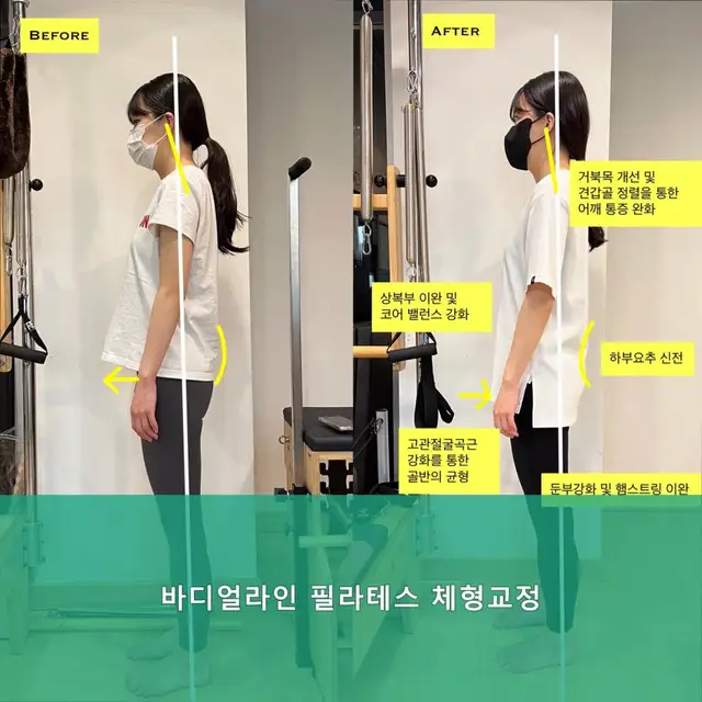 바디얼라인 사진 3