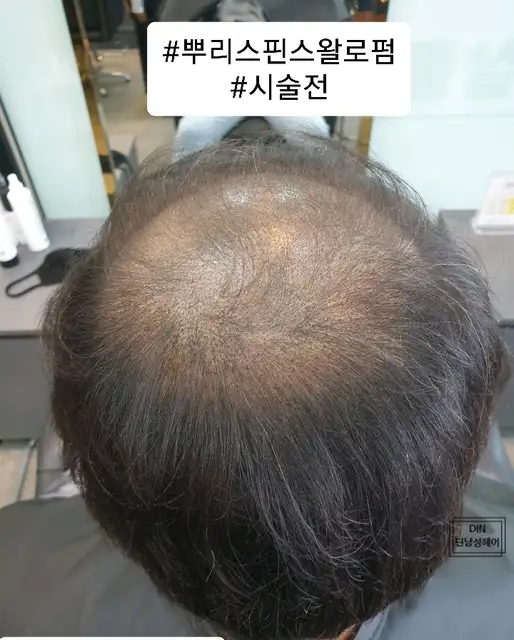 딘남성헤어 사진 4