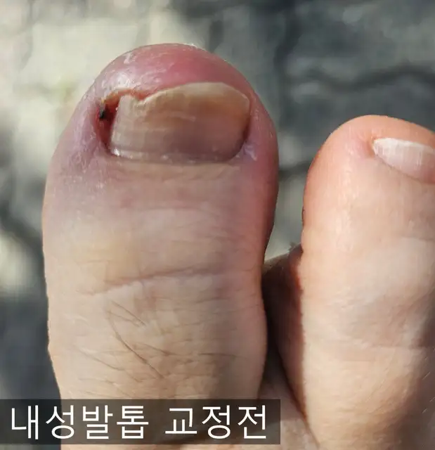 온리케어 사진 8