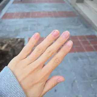 슈슈네일 사진