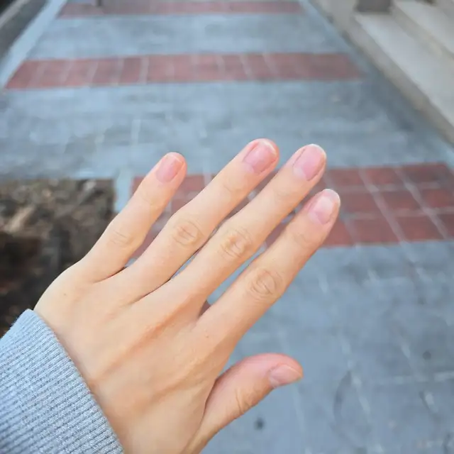 슈슈네일 사진 1