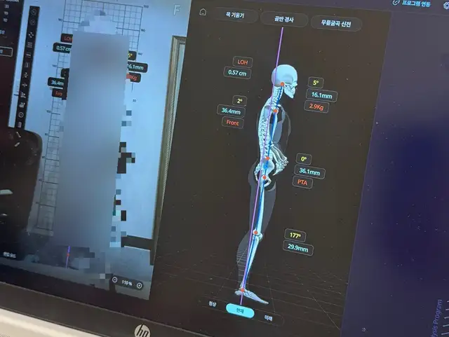 림프핏 에스테틱 사진 5