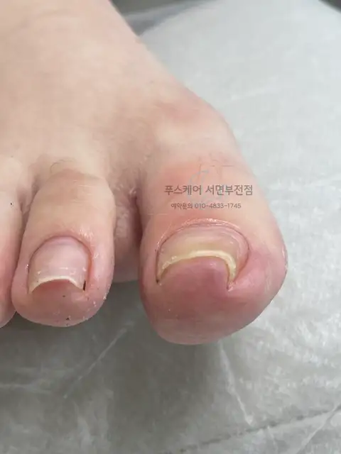 푸스케어 서면부전점 핑풋 사진 5