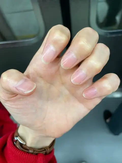 플루아네일 사진 8