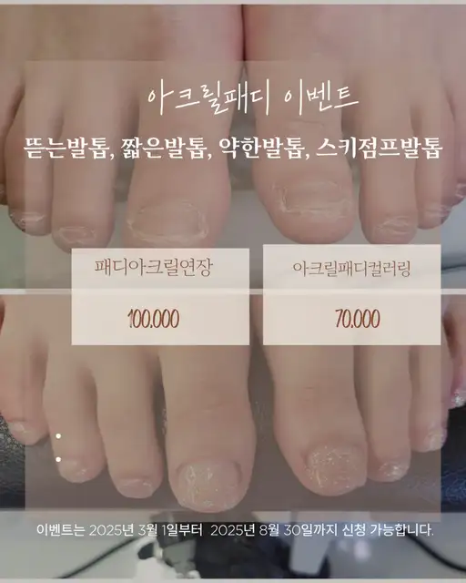 빛담네일 사진 2