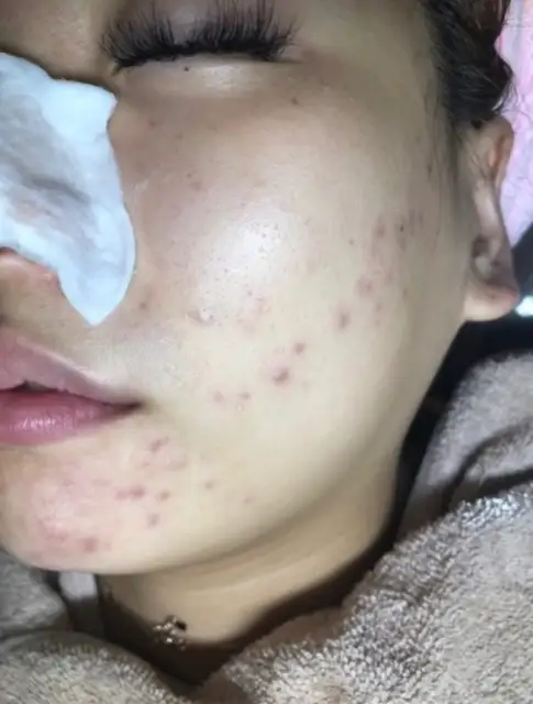 윤스킨 사진 8