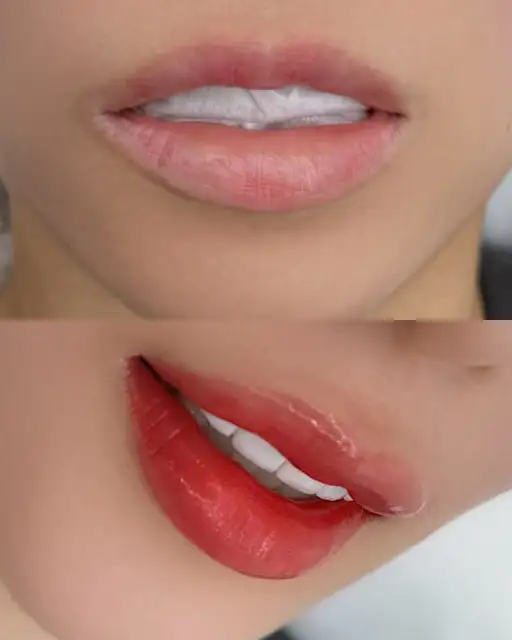 벨무드 사진 6