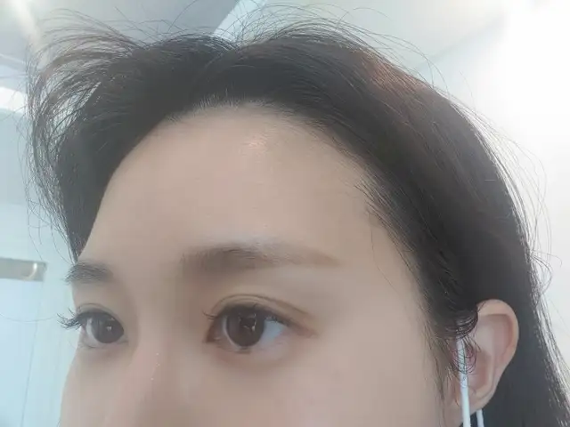 스킨핏에스테틱 사진 7