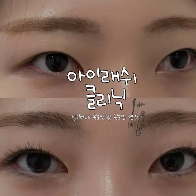 아이래쉬클리닉 사진 3