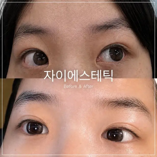 자이에스테틱 사진 5
