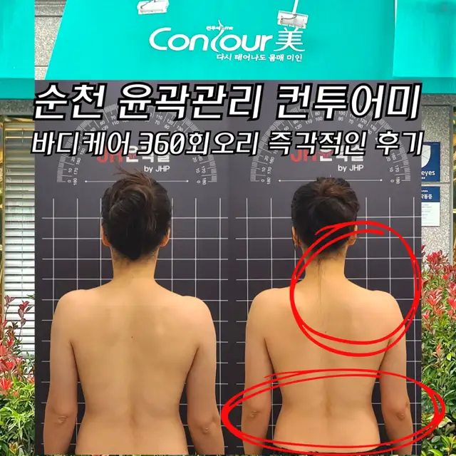 컨투어미 사진 7