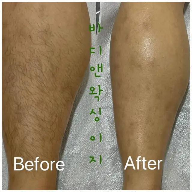 바디앤왁싱이지 사진 4