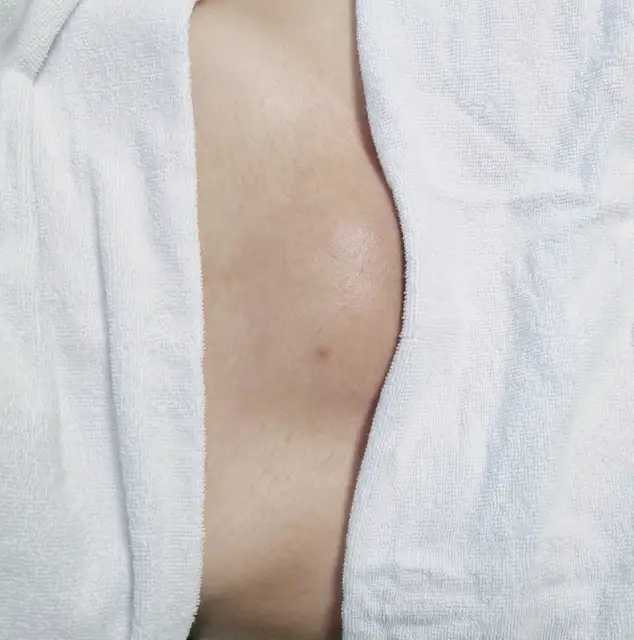 얀별슈가링 사진 2