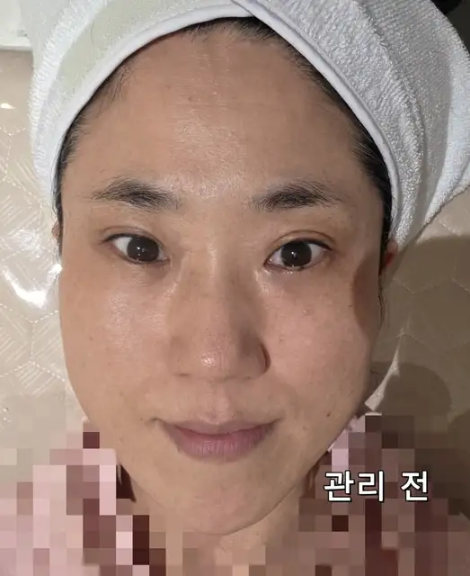 데자뷰메디스킨 사진 4